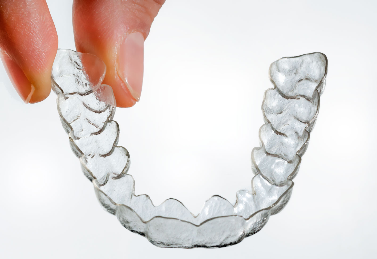 Leichte bis mittlere Zahnfehlstellungen, können mit Alignern fast unsichtbar korrigiert werden. Foto dietrich Hackenberg - lichtbild.org